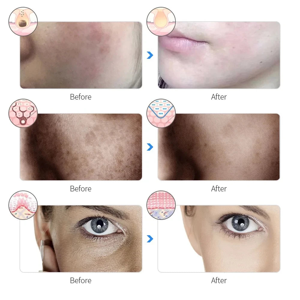 Rechargeable LED Facial Mask